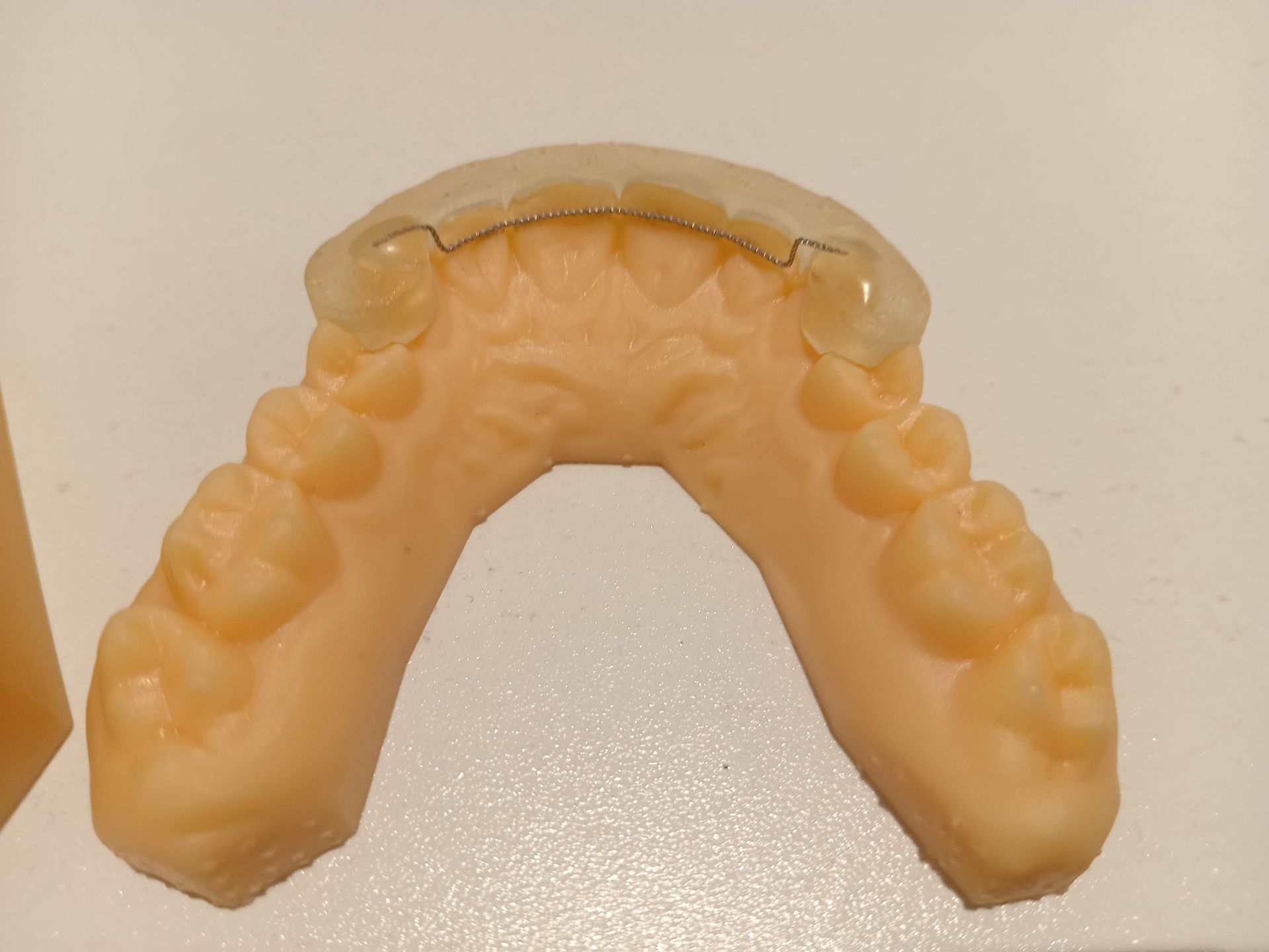 Providental ProviDental Laboratories - clear aligners; retainers; 3D