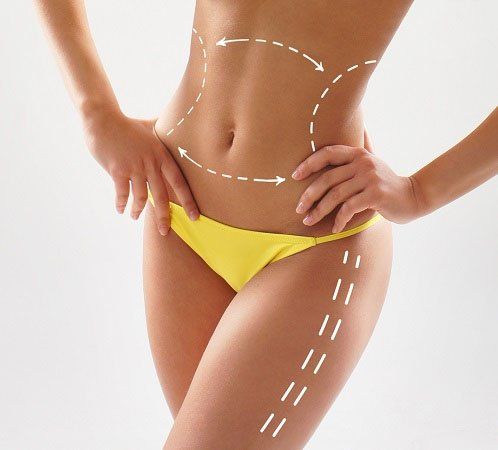 liposuction in mexico
