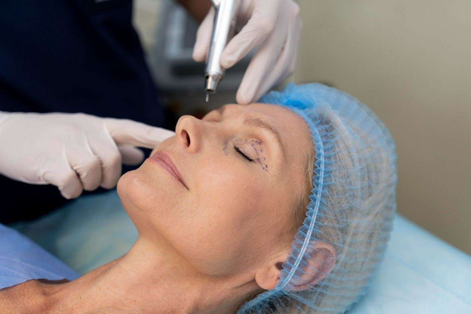 A woman is getting a laser treatment on her face.