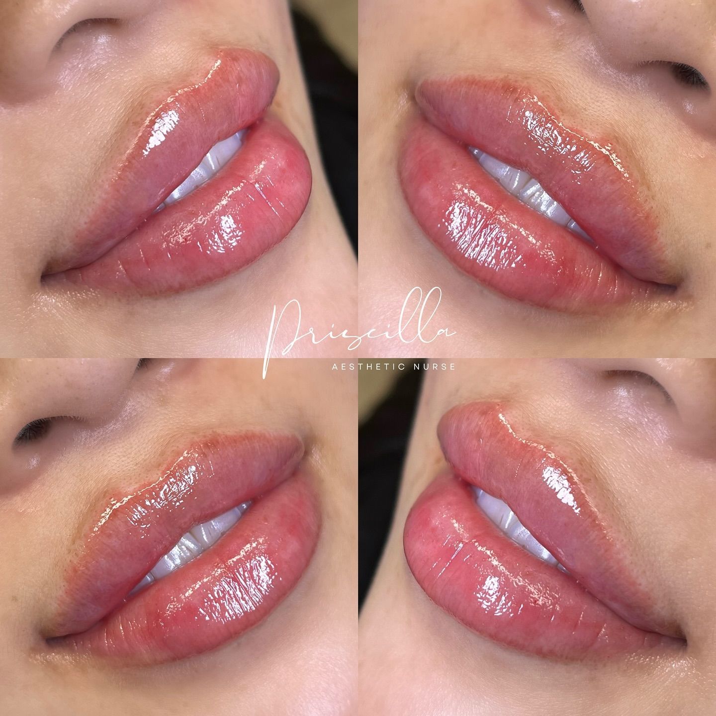 a close up of a woman 's lips with gloss on them