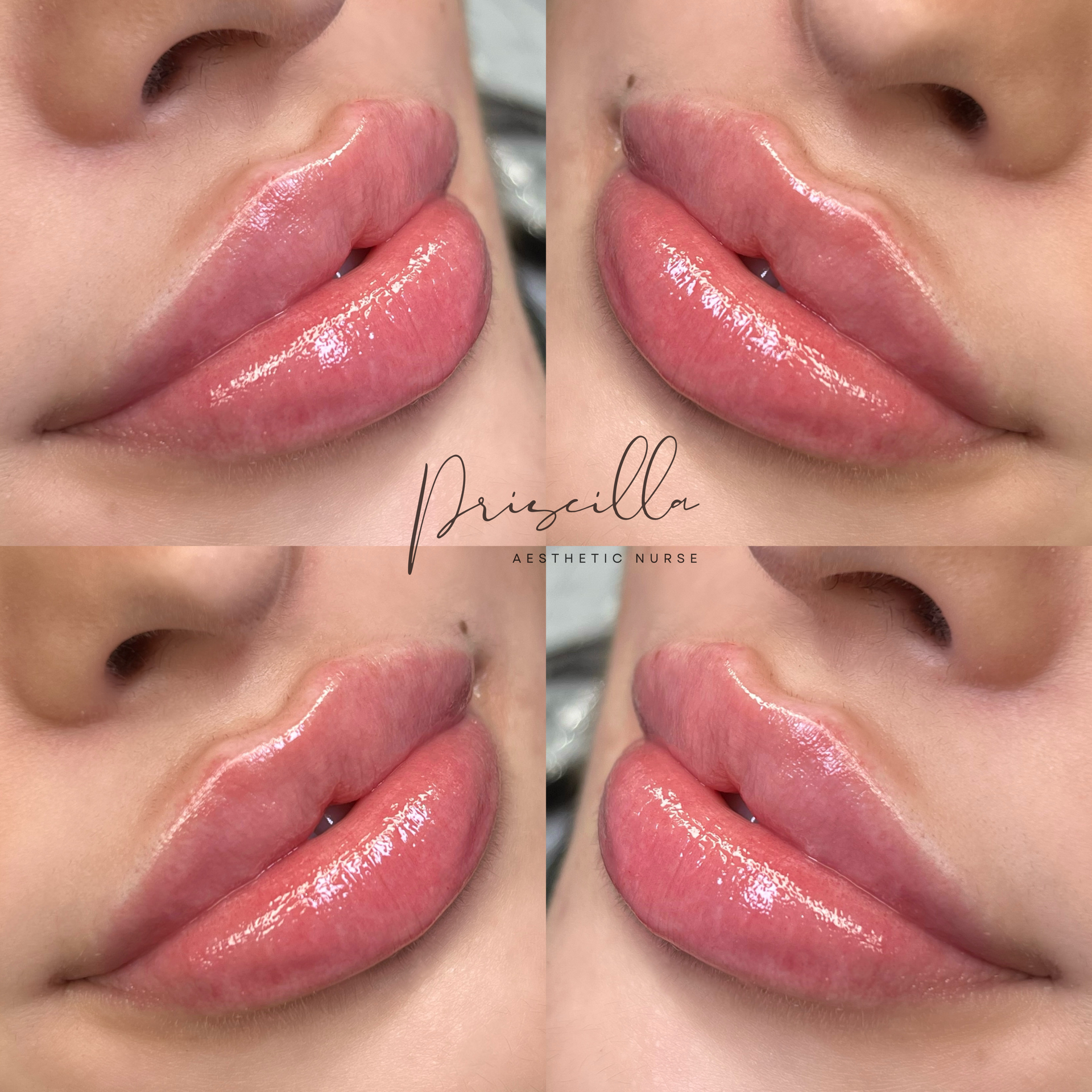 a close up of a woman 's lips with a lot of gloss on them .