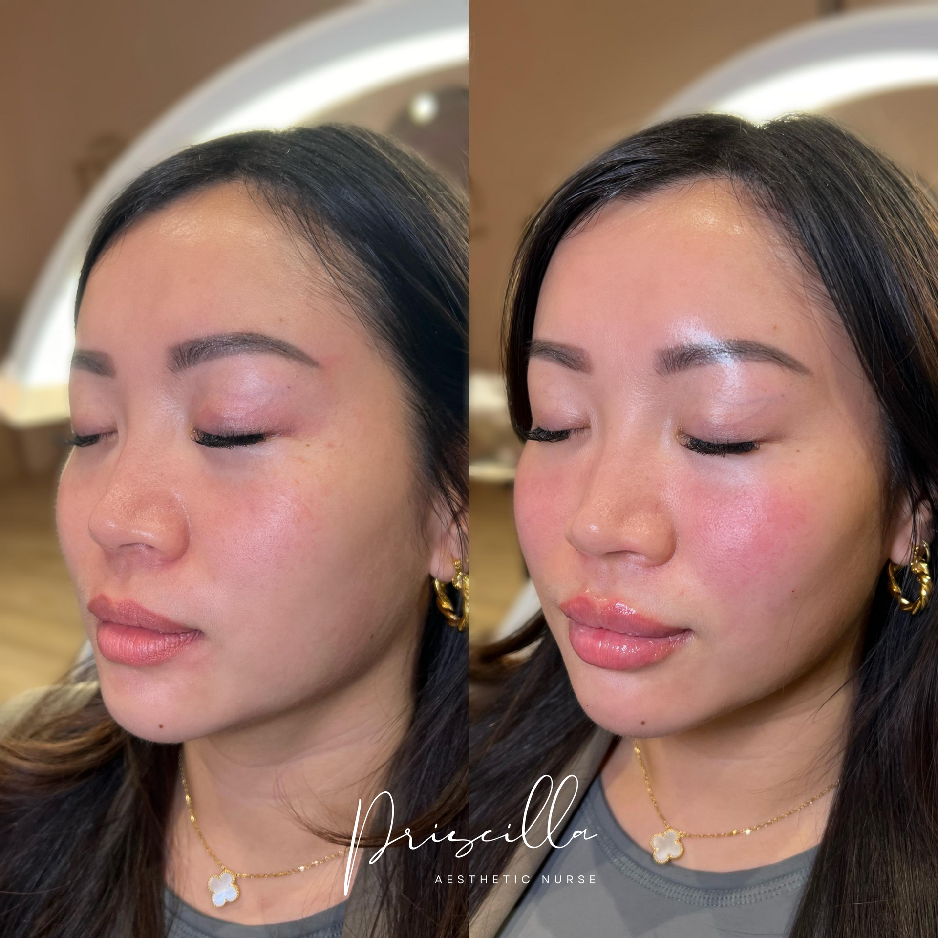 a before and after photo of a woman 's face