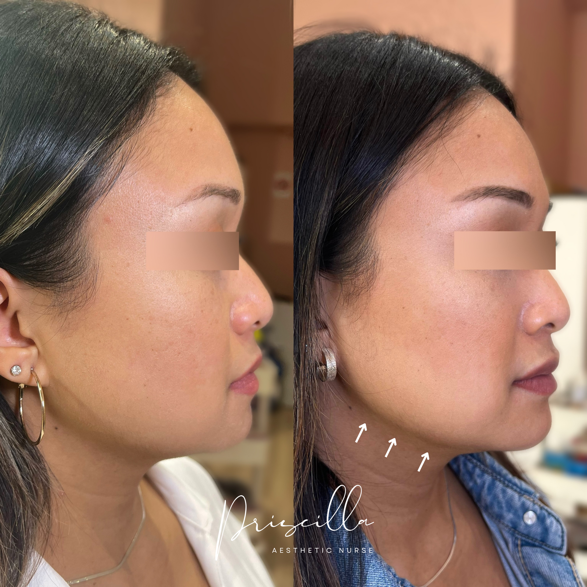 a before and after photo of a woman 's face