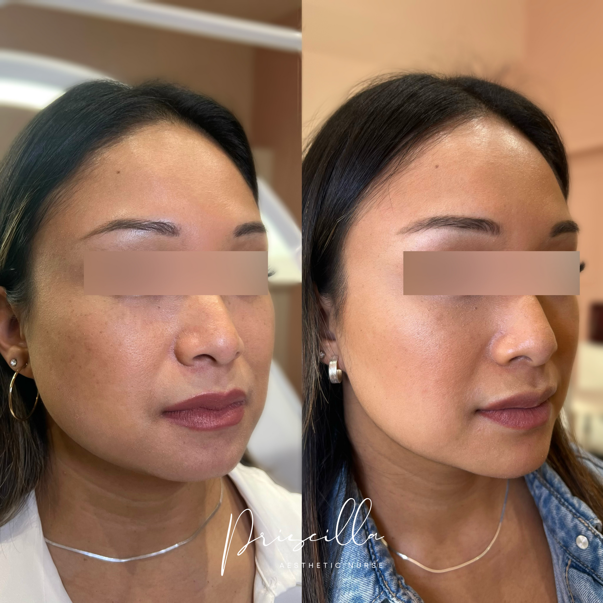 a before and after photo of a woman 's face