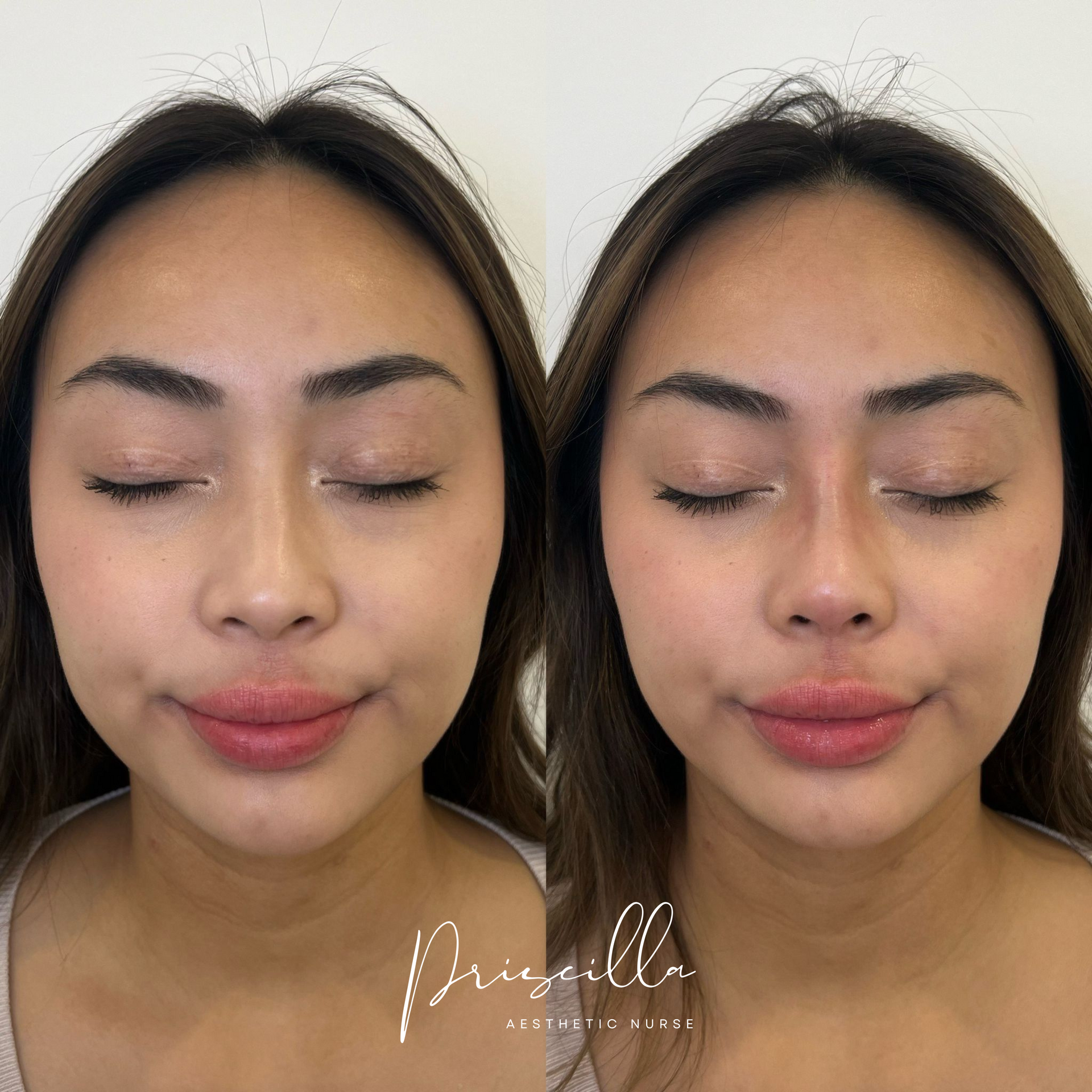 a before and after photo of a woman 's face