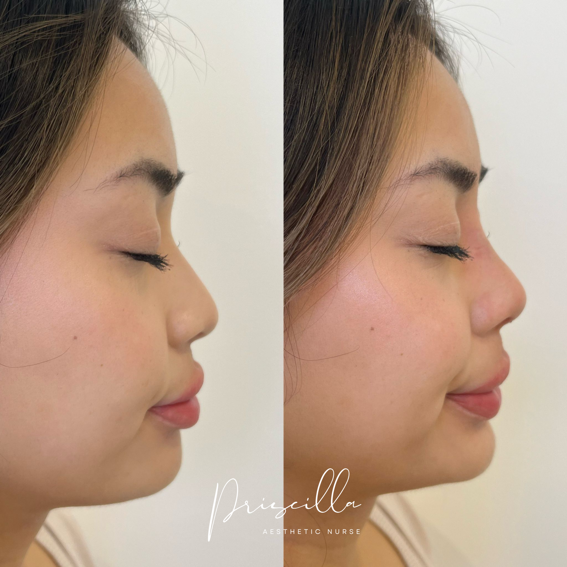 a before and after photo of a woman 's face .