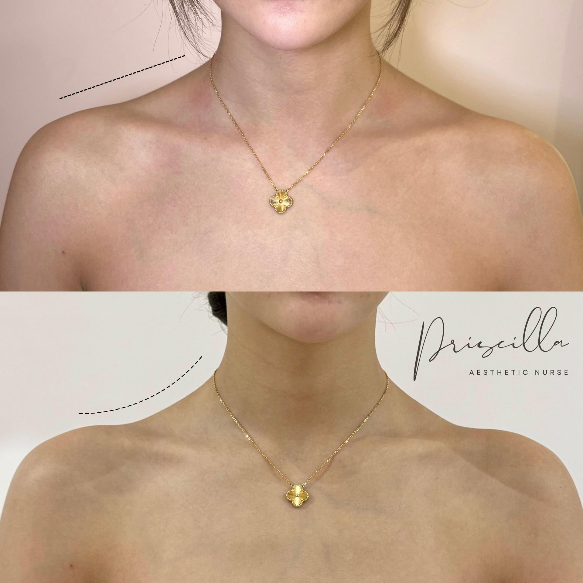 a before and after photo of a woman wearing a gold necklace
