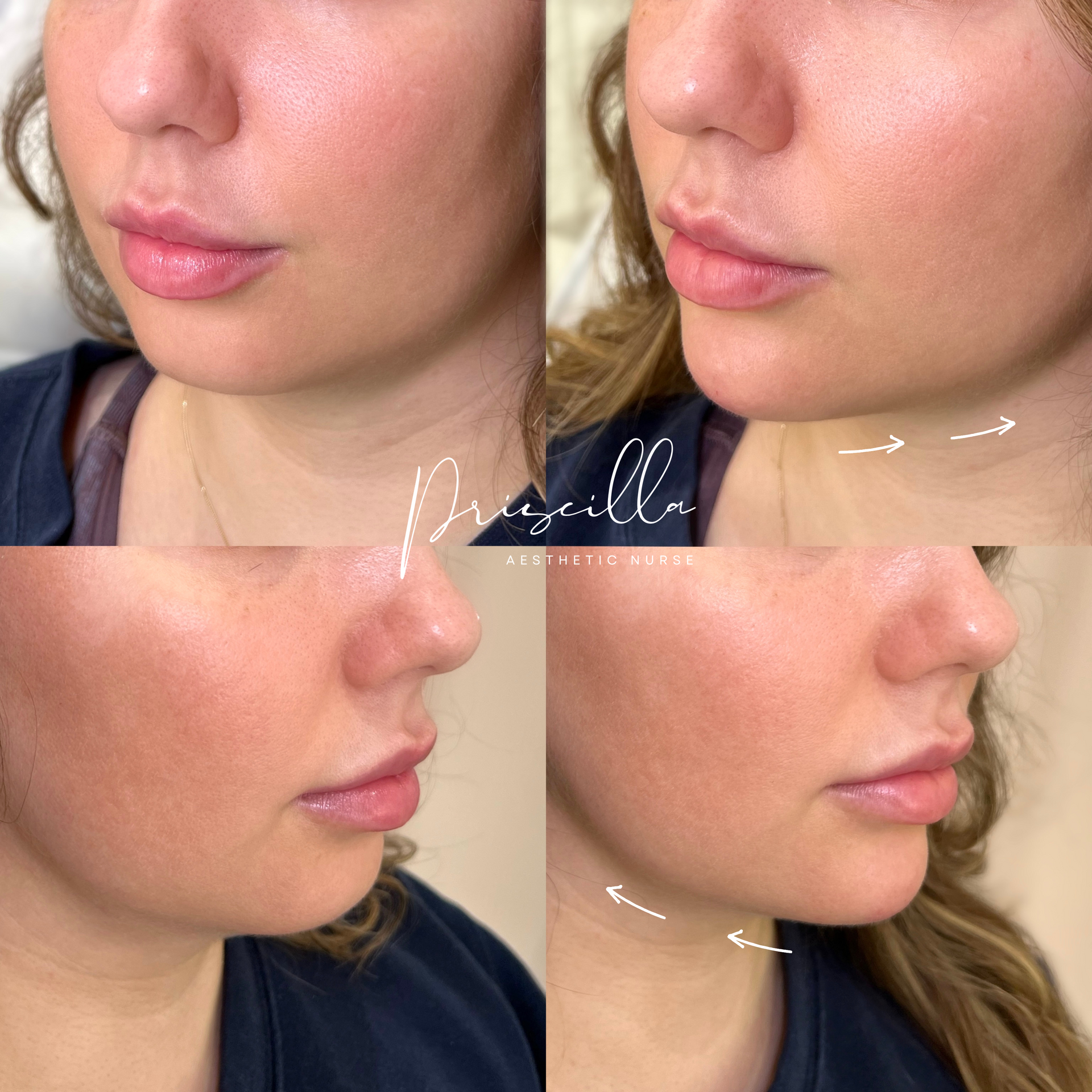 a before and after photo of a woman 's face .