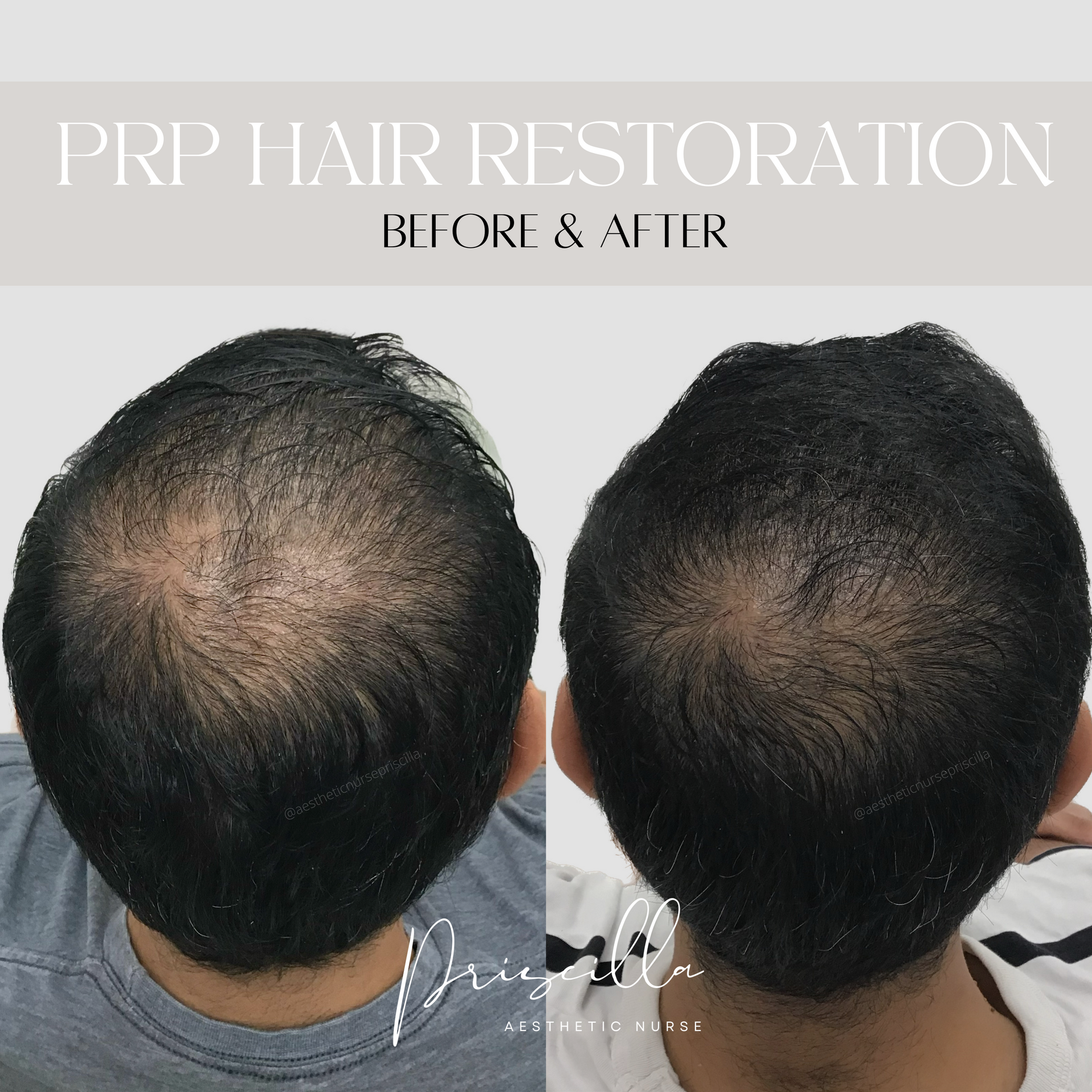 a before and after photo of a man 's head .