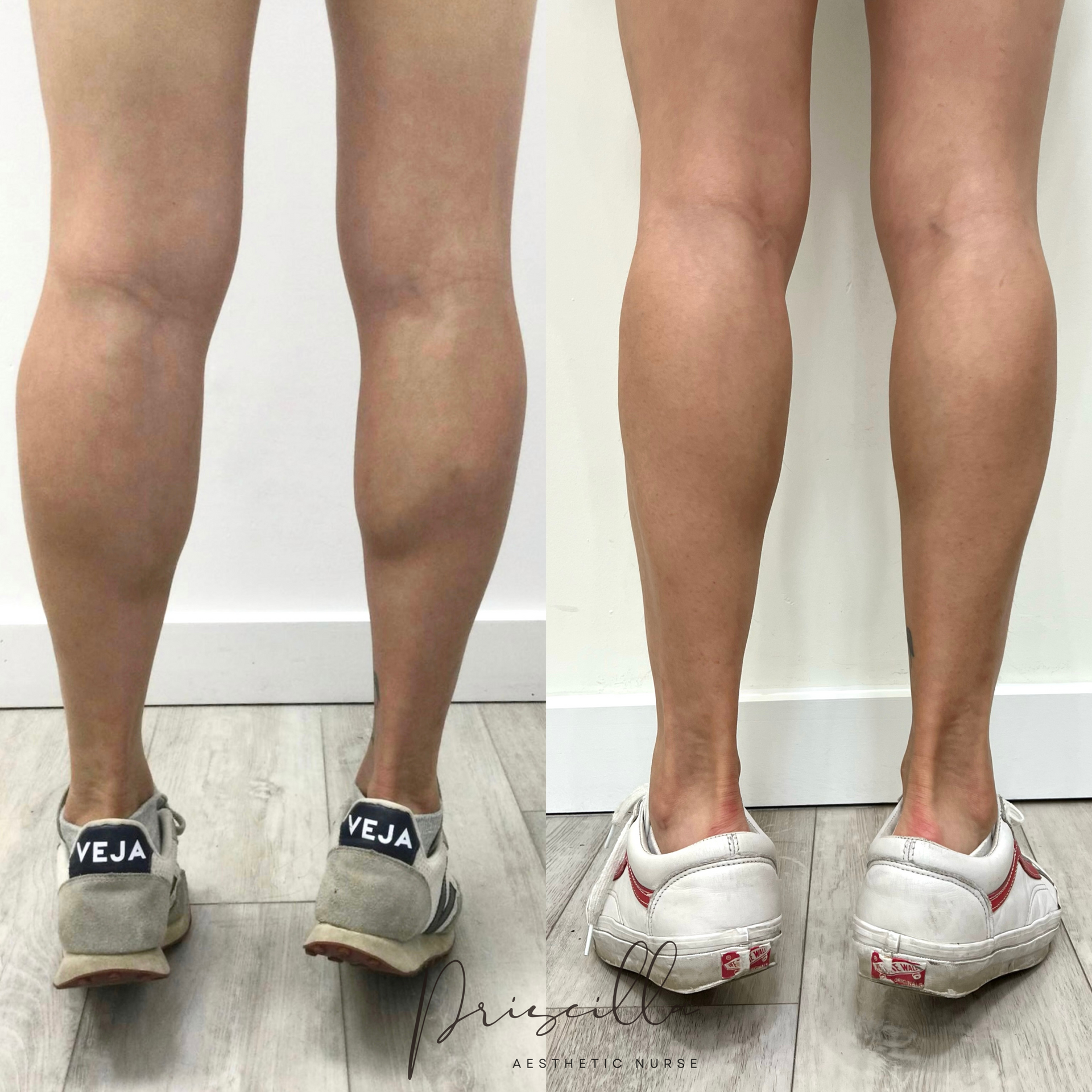a before and after photo of a woman 's legs.