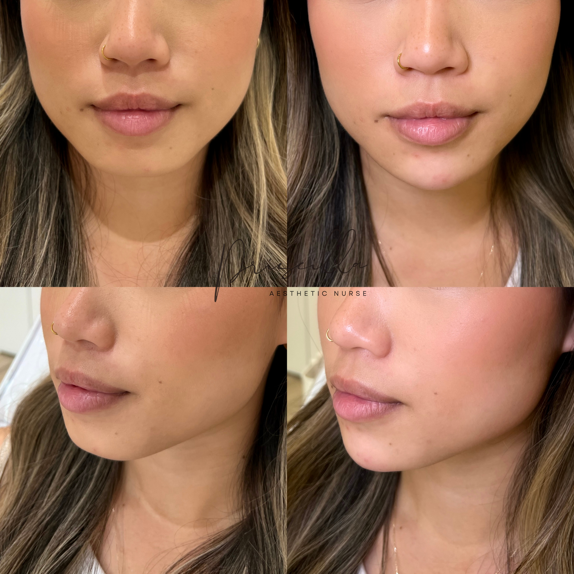 a before and after photo of a woman 's face .