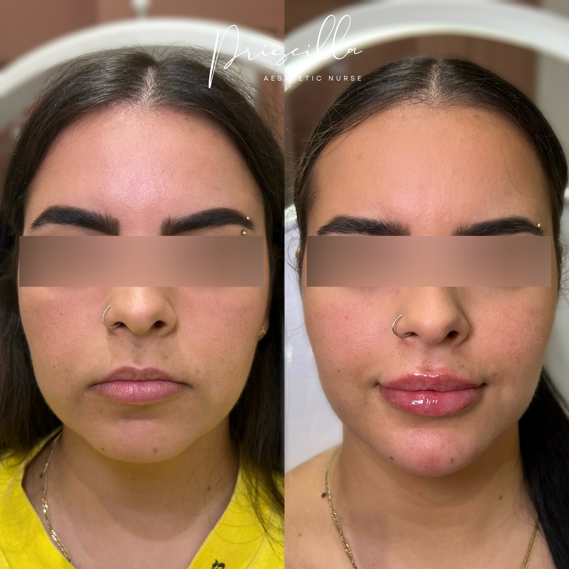 a before and after photo of a woman 's face .