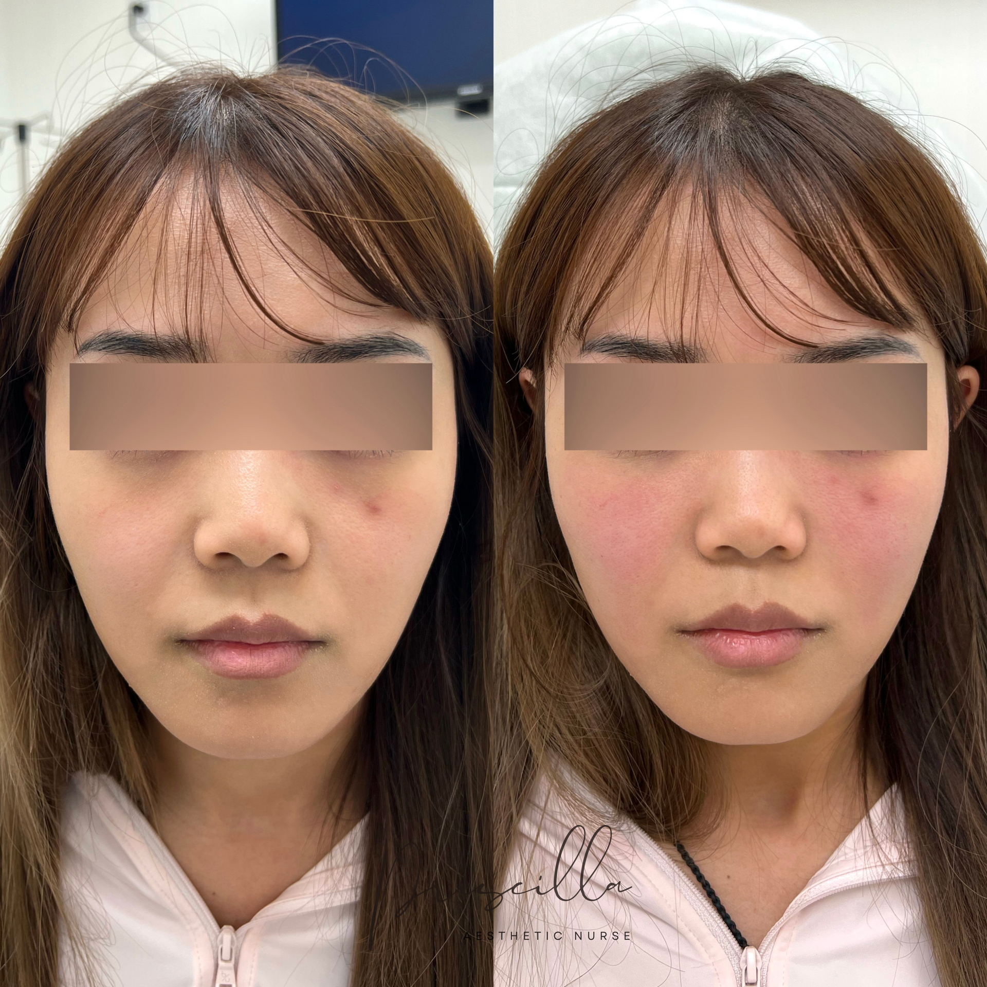 a before and after photo of a woman 's face .