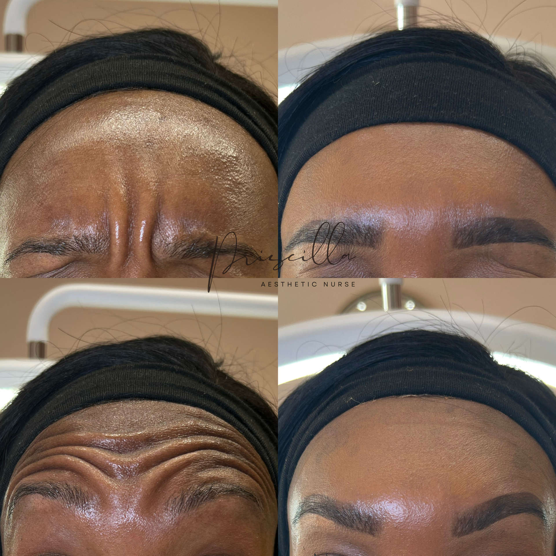 a before and after photo of a woman 's face