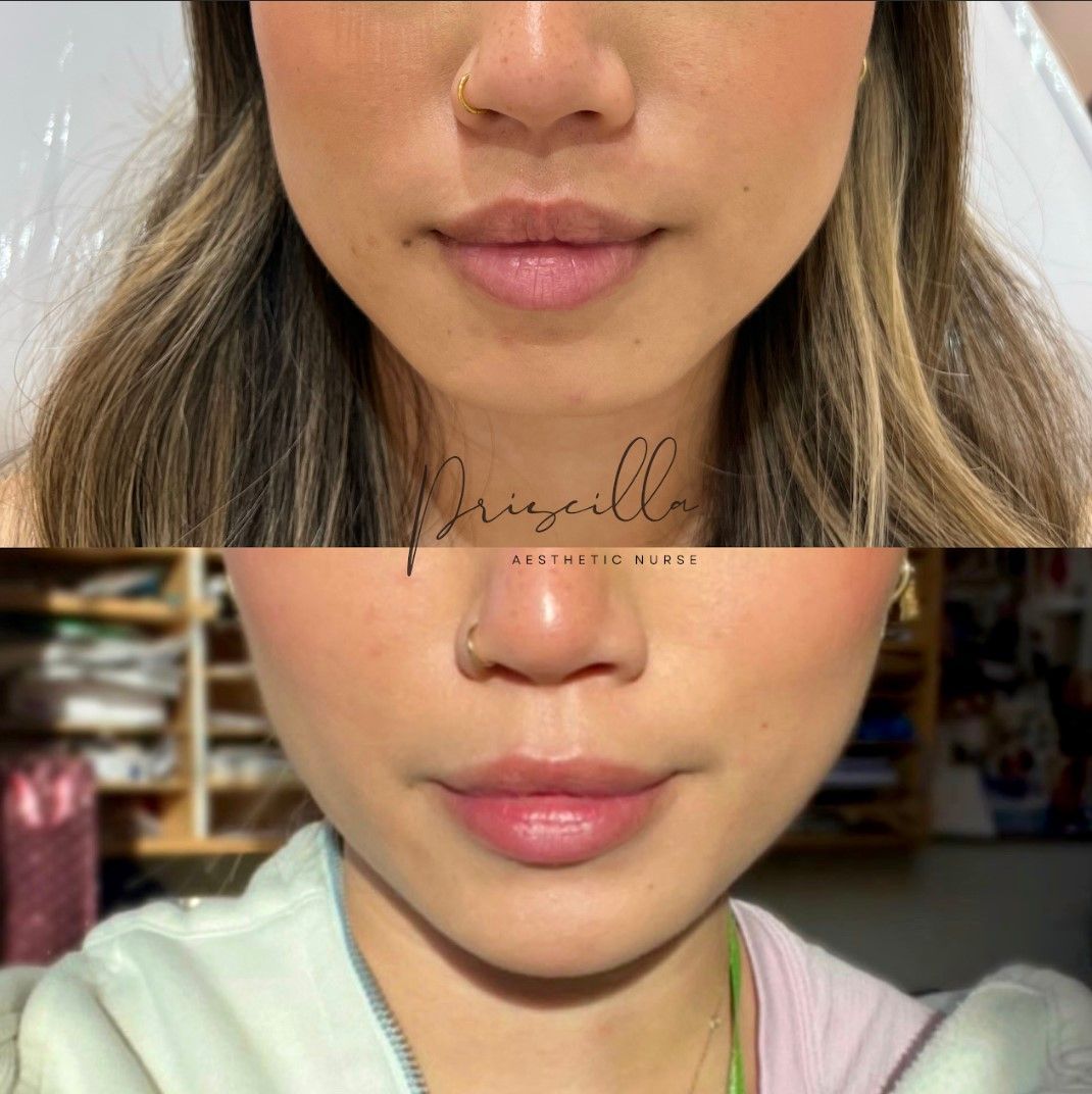 a before and after photo of a woman 's face