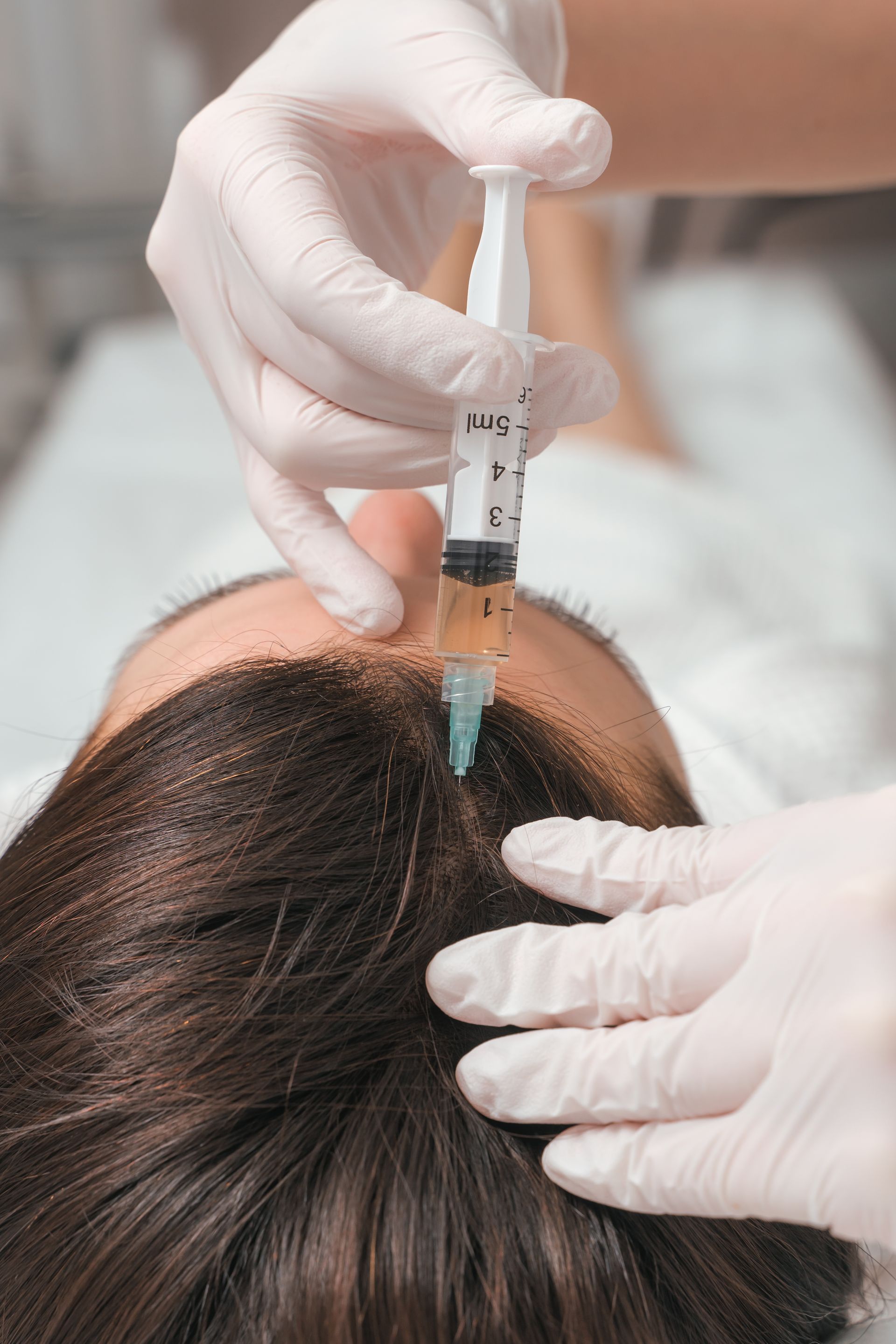 a woman is getting a hair treatment with a syringe .