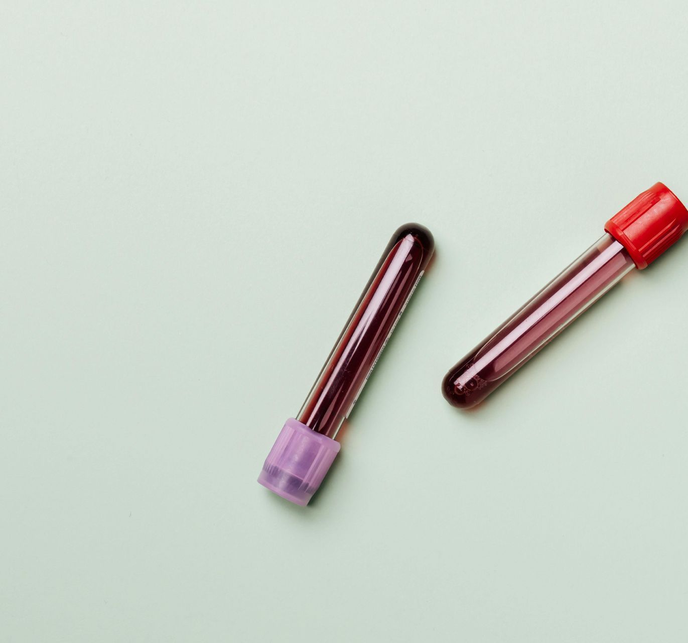 A woman is sitting in a dental chair with her hand on her face.