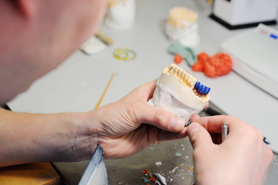 calco di arcata dentale