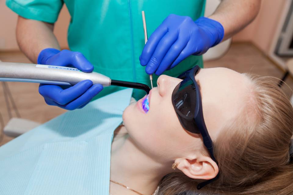 trattamento di sbiancamento denti con laser
