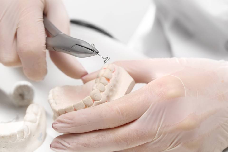 riproduzione di arcata dentale