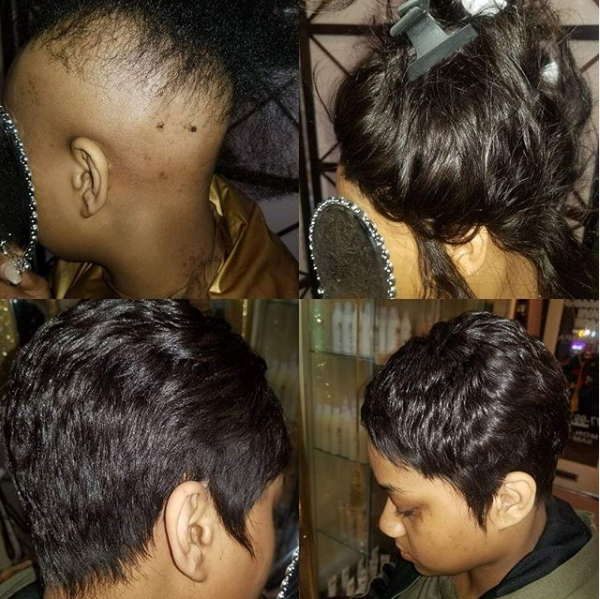 Nonsurgical Hair Replacement