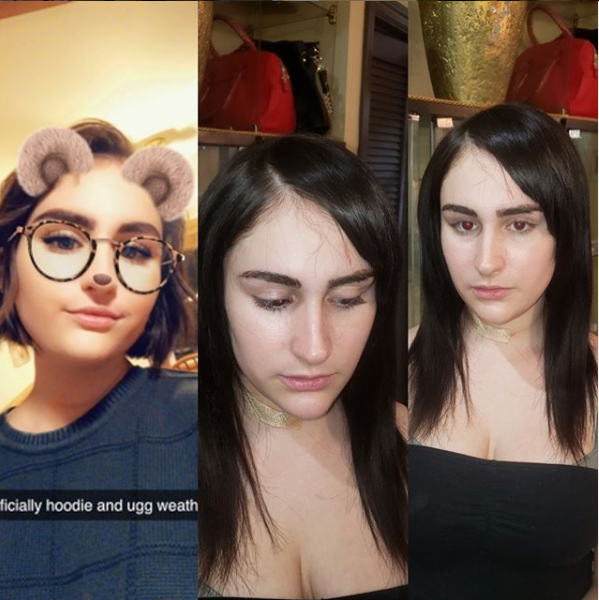 Micro Link Extensions