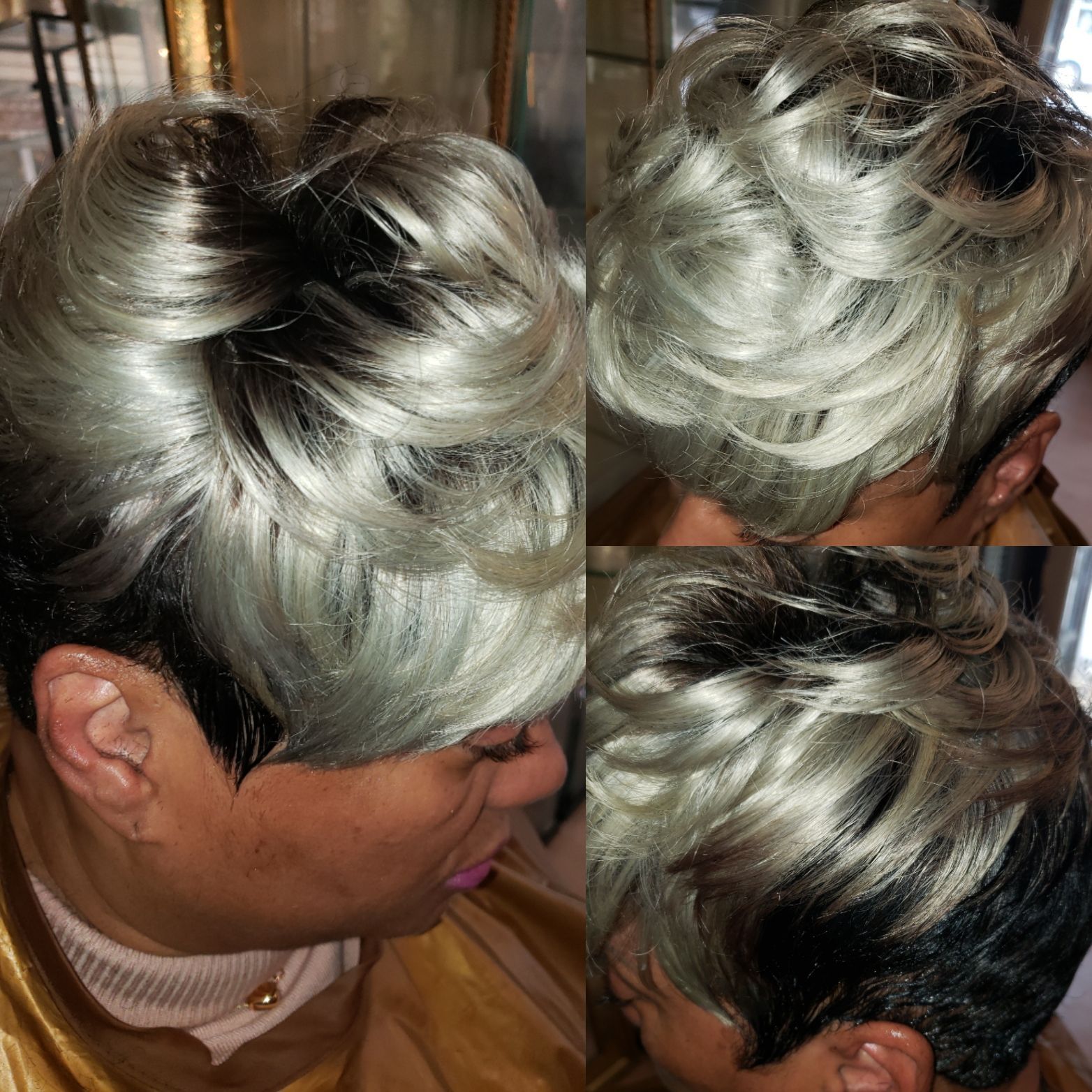 Nonsurgical Hair Replacement