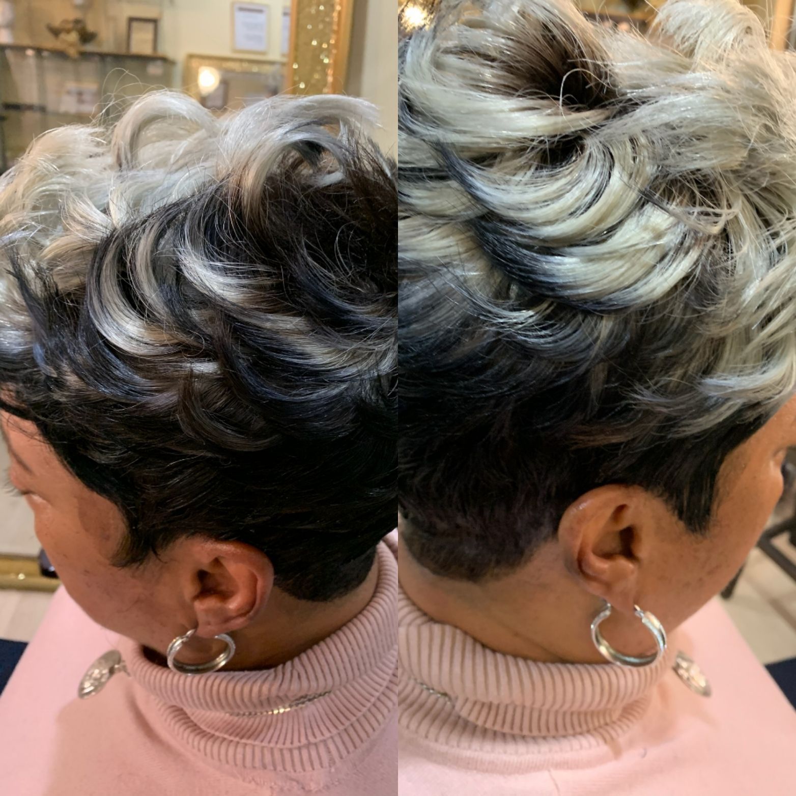 Nonsurgical Hair Replacement