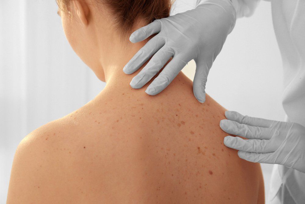 Doctor Examining Patient Skin — Deception Bay Doctors In Deception Bay, QLD