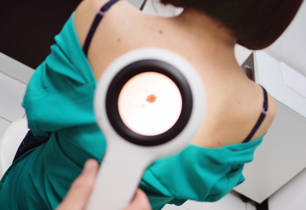 The Doctor Examines The Patients Birthmarks With A Special Electronic Magnifier — Deception Bay Doctors In Deception Bay, QLD