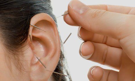 Acupuncture improves ovarian function