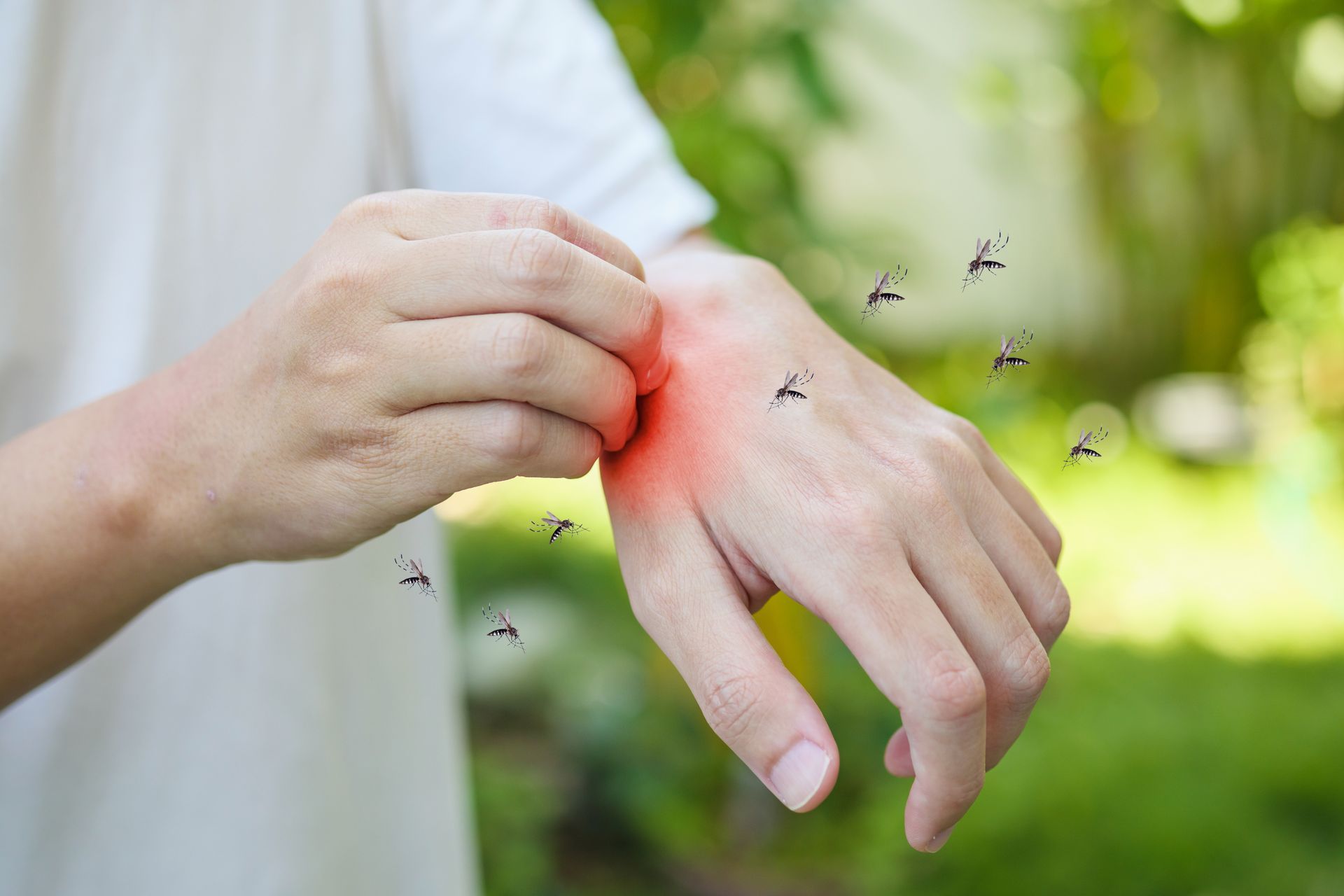 Un hombre se rasca la muñeca mientras los mosquitos vuelan a su alrededor.