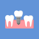 Dental Implant Icon