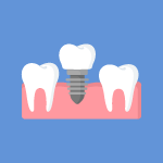Dental Implants Icon