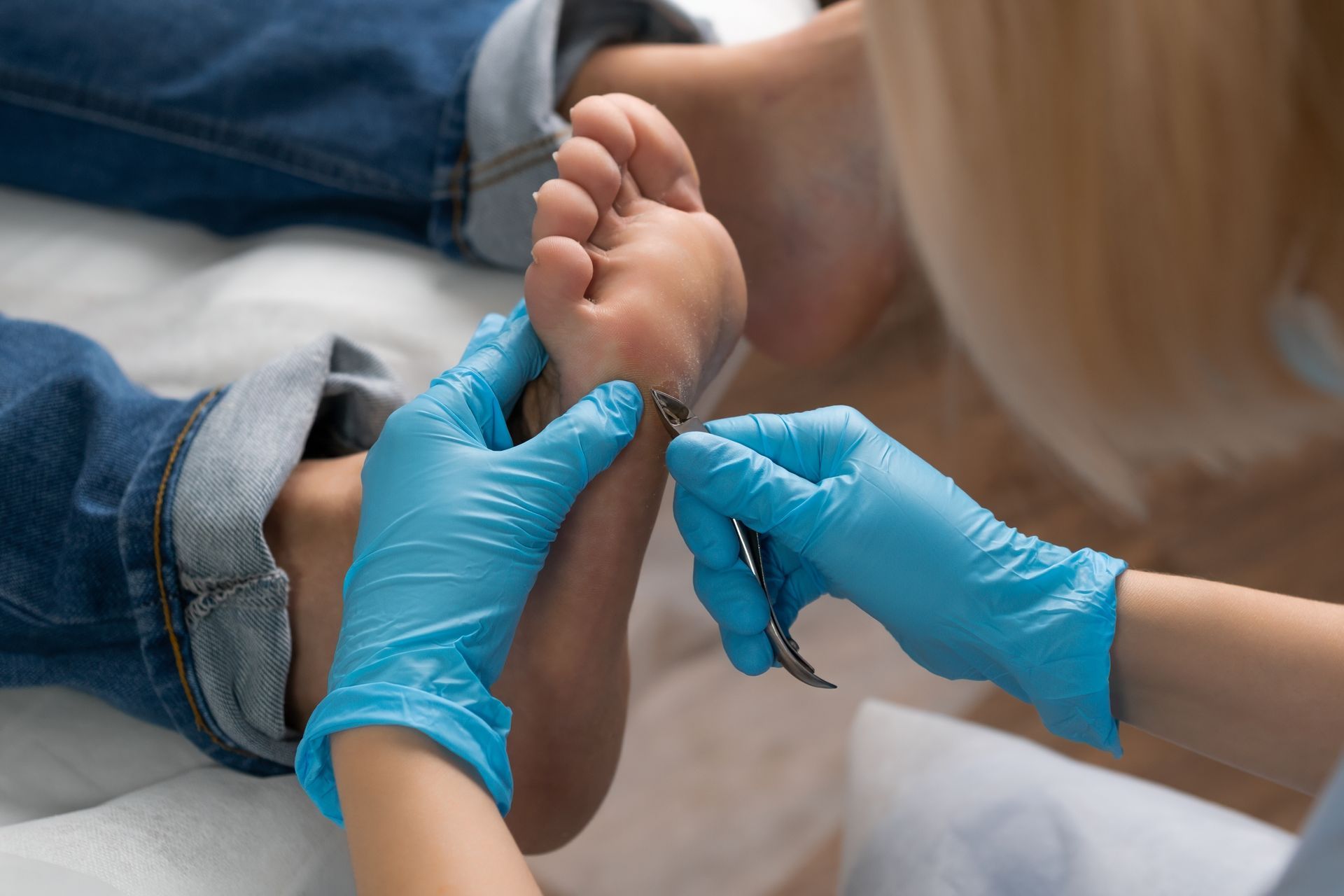Person's foot being treated by a person wearing blue gloves, using small tools on the sole, close up.