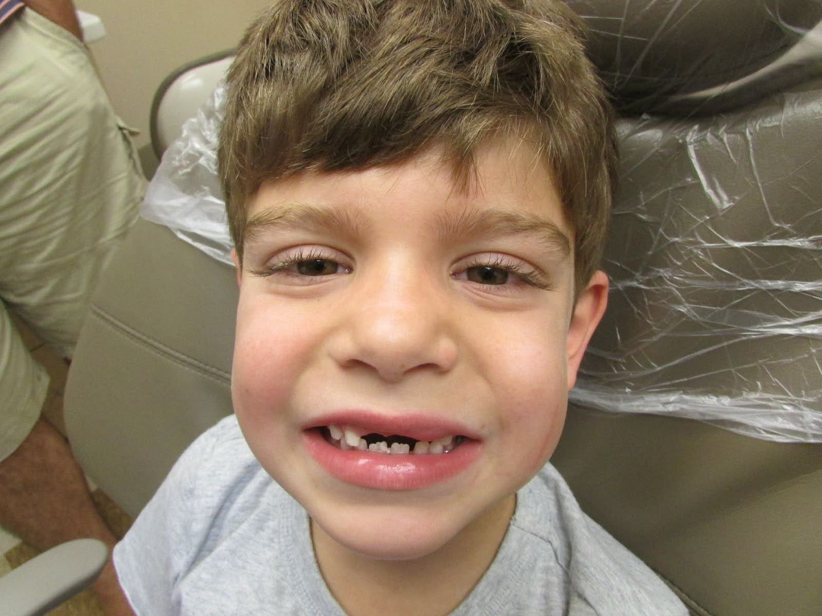 Smiling young boy with missing front teeth at a dental chair.