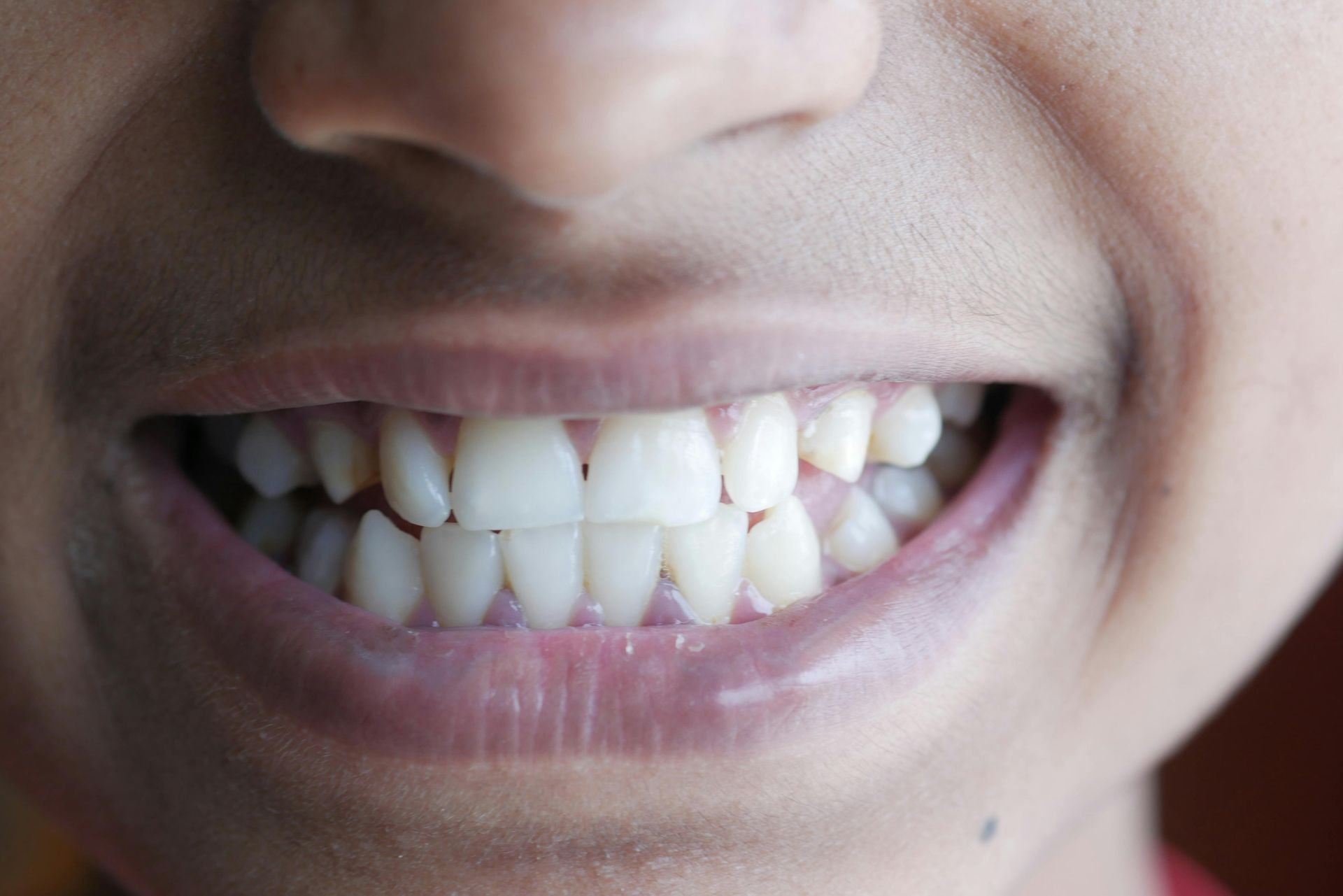 Close-up of a person smiling, showing white teeth and pink lips.