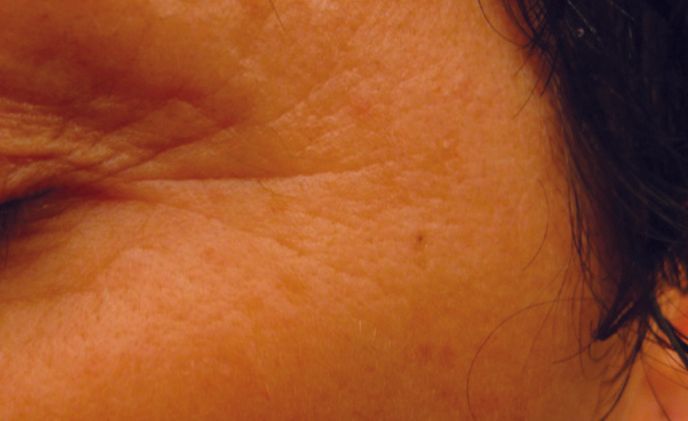 Een close-up van het gezicht van een vrouw met rimpels en haar.