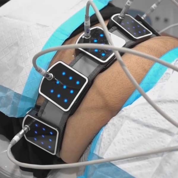 A person is lying on a table with a device on their leg having a Body Contouring treatment for weight loss