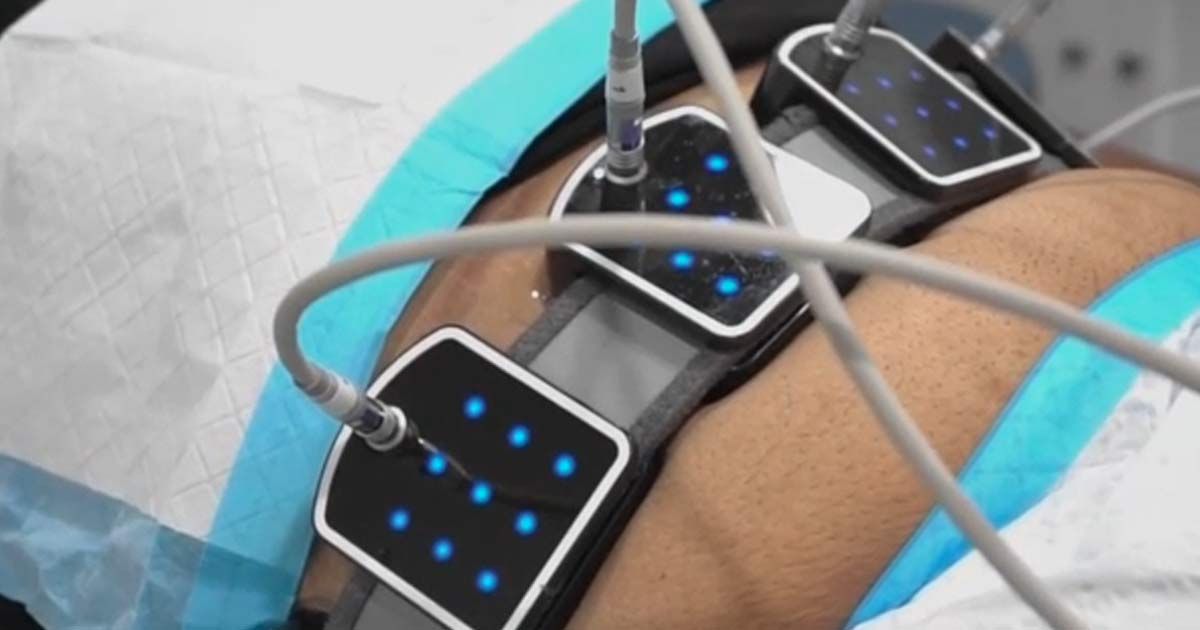A person is lying on a bed with a machine on their legs getting Body Contouring NJ and NYC - Victory Medical Institute
