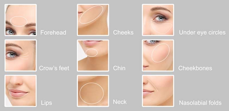 A woman's face is showcased in various areas of Cosmetic Treatments in NJ and NYC at Victory Medical Institute.