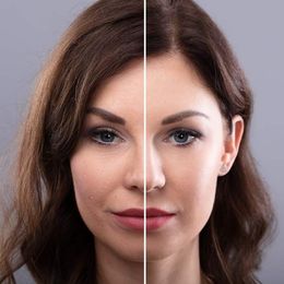 A before-and-after photo of a woman's face from advanced cosmetic treatments at Victory Medical Institute Transform Your Health, Renew Your Vitality, Serving Patients in Morris Plains, New Jersey, and Manhatta,n New York