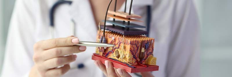 A doctor is holding a model of the skin with tweezers, showing the patient the need for Medical Hair Treatments NJ and NYC at Victory Medical Institute