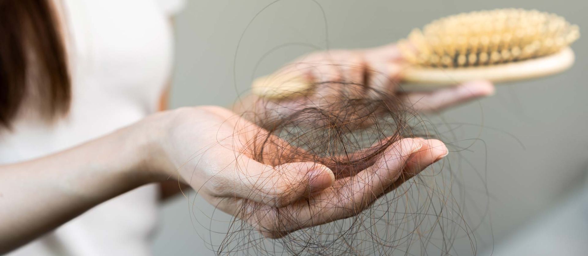 A woman is holding a brush and hair in her hand needing Hair Rejuvenation with Plasma-Rich Platelets Treatments