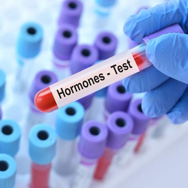 A person is holding a test tube that says hormones test for Hormone Imbalances