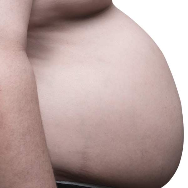 A close-up of a man with Insulin Resistance belly with a white background