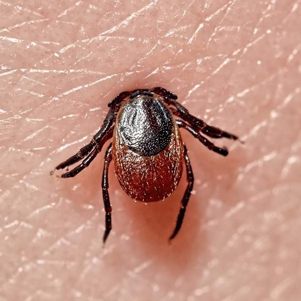 A close-up of a tick infected with Lyme Disease on a person's skin