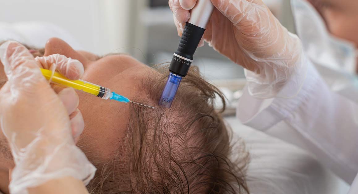 A man is getting Medical Hair Rejuvenation NJ and NYC by Victory Medical Institute