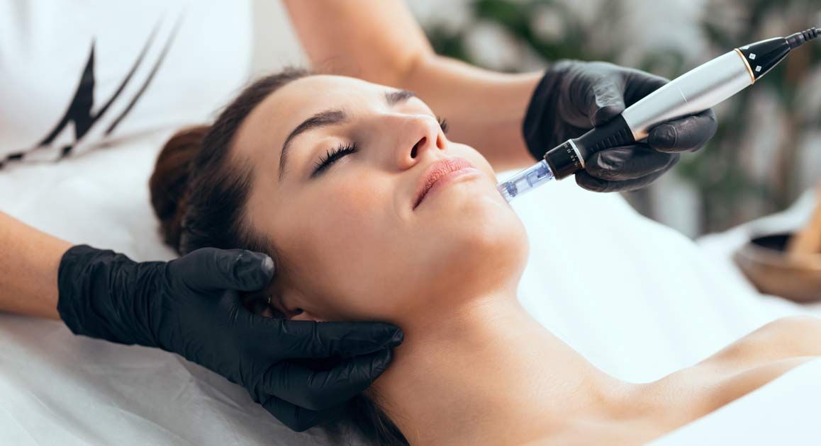 A woman is getting Medical Microneedling NJ and NYC at Victory Medical Institute