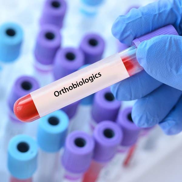 A person holding a test tube that says orthobiologys representing Advanced Orthobiologic Therapy for Neurodegenerative Diseases Serving Patients in Morris Plains New Jersey and Manhattan New York